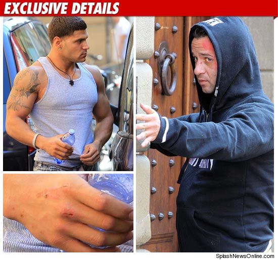 jersey shore ronnie beats up situation. RONNIE came back with his